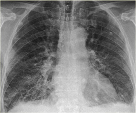 Patrón reticular, imágen en forma de malla o retícula.