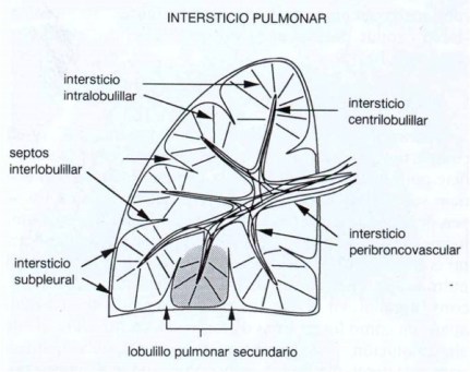 Esquema.