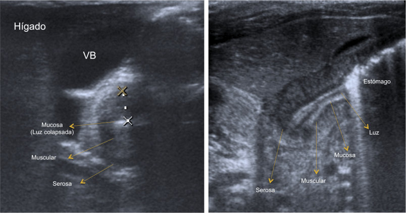 Esquema axial y longitudinal.