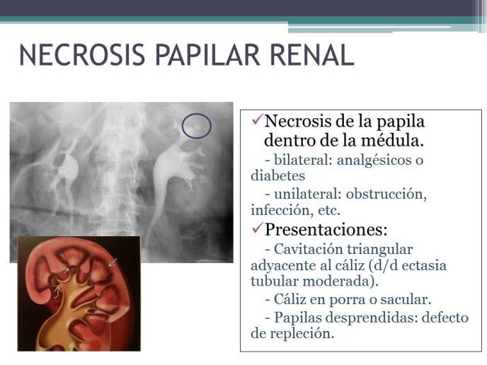 Diapositiva13_11