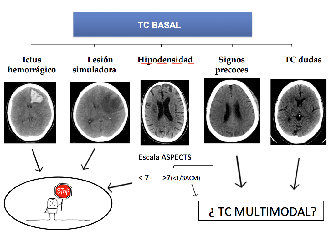 Captura de pantalla 2016-07-17 a las 20.28.42.png