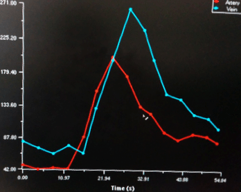 Captura de pantalla 2016-07-17 a las 20.49.18.png