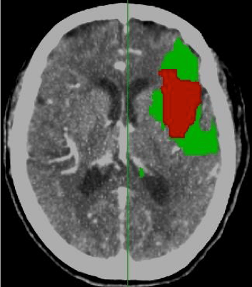 Captura de pantalla 2016-07-17 a las 21.09.53.png