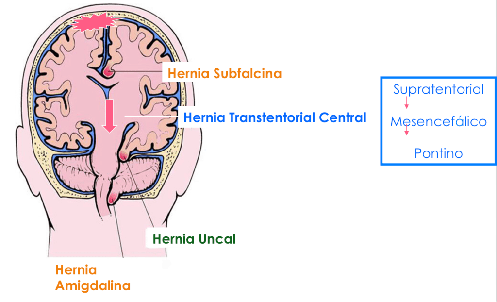 Herniaciones
