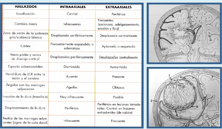 Esquema Intra o Extra axial