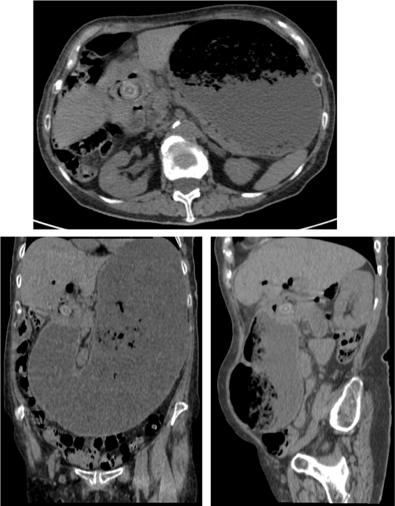 Correlacion con las imagenes anteriores